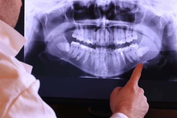 Best Emergency Dental Care for Broken or Chipped Teeth in Centralia, IL